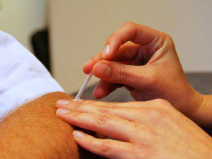 Dry Needling in Lisse